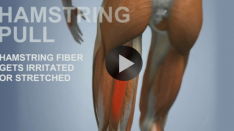 hamstringFI